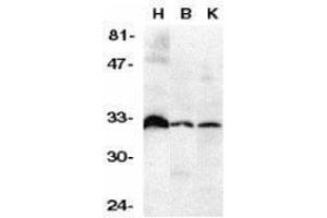Western Blotting (WB) image for anti-Tumor Necrosis Factor Receptor Superfamily, Member 6b, Decoy (TNFRSF6B) (N-Term) antibody (ABIN2473237) (TNFRSF6B 抗体  (N-Term))