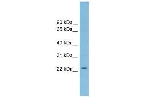 RNF125 antibody used at 1 ug/ml to detect target protein. (RNF125 抗体  (Middle Region))