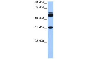 CYLC2 antibody used at 1 ug/ml to detect target protein. (CYLC2 抗体  (C-Term))