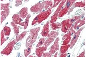 Human Heart (formalin-fixed, paraffin-embedded) stained with CRYAB antibody ABIN462098 at 10 µg/ml followed by biotinylated goat anti-rabbit IgG secondary antibody ABIN481713, alkaline phosphatase-streptavidin and chromogen. (CRYAB 抗体)
