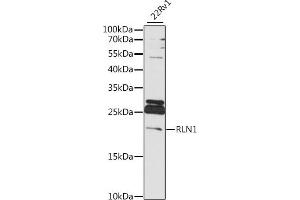Western blot analysis of extracts of 22Rv1 cells, using RLN1 antibody (ABIN7269906) at 1:1000 dilution. (Relaxin 1 抗体  (AA 1-100))