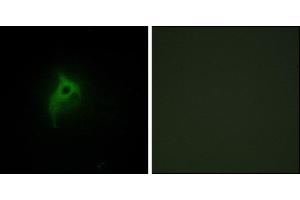 Immunofluorescence analysis of HepG2 cells, using Adrenergic Receptor alpha-2B antibody. (ADRA2B 抗体)
