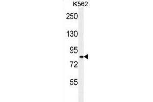 Western Blotting (WB) image for anti-Deafness, Autosomal Recessive 31 (DFNB31) antibody (ABIN2996024) (DFNB31 抗体)