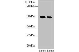 Western blot All lanes: LCAT antibody at 2 μg/mL Lane 1: EC109 whole cell lysate Lane 2: 293T whole cell lysate Secondary Goat polyclonal to rabbit IgG at 1/10000 dilution Predicted band size: 50 kDa Observed band size: 50 kDa (LCAT 抗体  (AA 25-433))