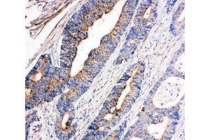 Immunohistochemistry (IHC) image for anti-Nuclear Receptor Subfamily 4, Group A, Member 3 (NR4A3) (AA 612-631) antibody (ABIN3032066)