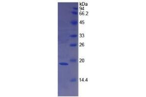 SDS-PAGE analysis of Human F8 Protein. (Factor VIII 蛋白)
