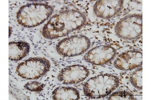 Immunoperoxidase of monoclonal antibody to SGK3 on formalin-fixed paraffin-embedded human colon.