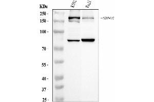 Western blot analysis of SBNO1 using anti-SBNO1 antibody (ABIN7601710). (SBNO1 抗体  (AA 43-1303))