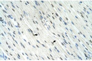 Human Muscle; SERTAD1 antibody - N-terminal region in Human Muscle cells using Immunohistochemistry (SERTAD1 抗体  (N-Term))