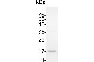SDS-PAGE (SDS) image for Interleukin 18 (IL18) (Active) protein (His tag) (ABIN7884464)