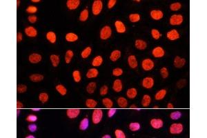 Immunofluorescence (IF) image for anti-DNA (Cytosine-5-)-Methyltransferase 3 alpha (DNMT3A) (2meLys44) antibody (ABIN7258842)