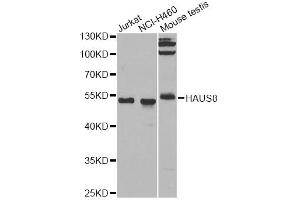 Western blot analysis of extracts of various cell lines, using HAUS8 antibody. (NYS48/HAUS8 抗体)