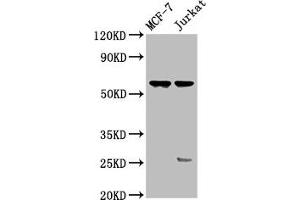 Western Blot Positive WB detected in: MCF-7 whole cell lysate, Jurkat whole cell lysate All lanes: STRA8 antibody at 3. (STRA8 抗体  (AA 115-241))