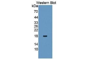 WB of Protein Standard: different control antibodies against Highly purified E. (FAS CLIA Kit)