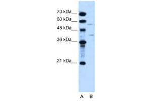 Image no. 1 for anti-Dihydroorotate Dehydrogenase (DHODH) (AA 112-161) antibody (ABIN204980) (DHODH 抗体  (AA 112-161))