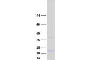 Western Blotting (WB) image for T-Cell Leukemia/lymphoma 1A (TCL1A) (Transcript Variant 2) protein (Myc-DYKDDDDK Tag) (ABIN2733367)