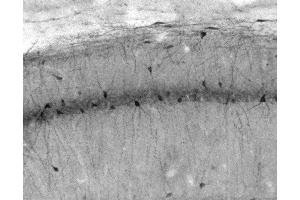 Adult rat hippocampus CA1 immunohistochemistry.