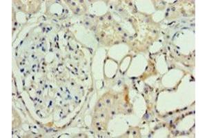 Western blot analysis of mouse brain tissue, using ASH2L antibody (3 μg/ml). (ASH2L 抗体  (AA 1-534))
