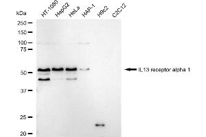 Western blotting analysis using IL13 receptor alpha 1 antibody (ABIN7799100).