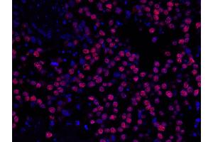 Immunofluorescence (IF) image for anti-Minichromosome Maintenance Complex Component 2 (MCM2) (AA 1-50) antibody (ABIN7448987)