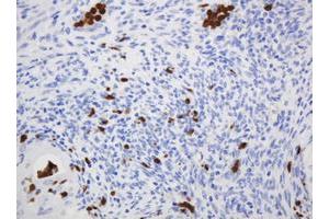 Image no. 1 for anti-CNKSR Family Member 3 (CNKSR3) antibody (ABIN1497550) (CNKSR3 抗体)