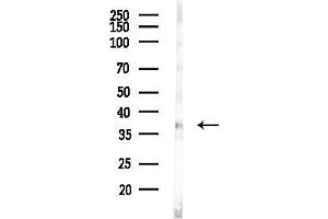Western blot analysis of lysates from Hela cells(LPS, 4h treatment), using GN Antibody at 1/1000 dilution.