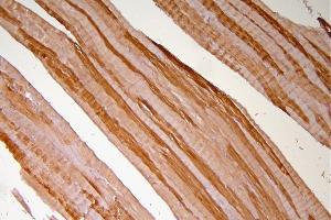 IHC analysis of Hsp20 using anti-Hsp20 antibody (ABIN5518920).