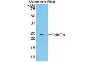 Western Blotting (WB) image for anti-Macrophage Stimulating 1 Receptor (C-Met-Related tyrosine Kinase) (MST1R) (AA 89-275) antibody (ABIN1859892) (MST1R 抗体  (AA 89-275))