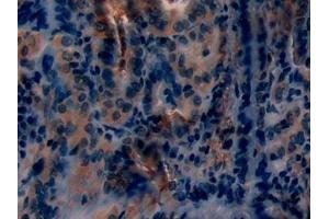 Immunohistochemistry (IHC) image for anti-Protein Kinase C, epsilon (PRKCE) (AA 403-672) antibody (ABIN7431791)