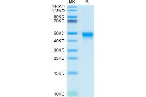 CD84 Protein (CD84) (AA 22-225) (His-Avi Tag)