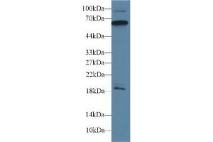 Detection of CAMK2g in Mouse Cerebrum lysate using Polyclonal Antibody to Calcium/Calmodulin Dependent Protein Kinase II Gamma (CAMK2g) (CAMKII gamma 抗体  (AA 6-208))