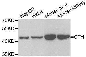 Western blot analysis of extracts of various cell lines, using CTH antibody. (CTH 抗体  (AA 1-405))