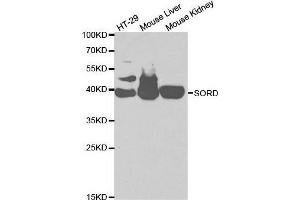Western blot analysis of extracts of various cell lines, using SORD antibody. (SORD 抗体  (AA 1-357))