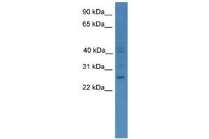 WB Suggested Anti-GCH1 Antibody Titration: 0. (GCH1 抗体  (C-Term))