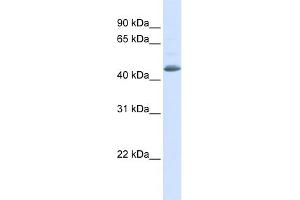WB Suggested Anti-SNX5 Antibody Titration: 0. (SNX5 抗体  (N-Term))