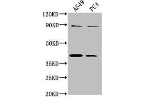 Western Blot Positive WB detected in: A549 whole cell lysate, PC3 whole cell lysate All lanes: ATP6V0D2 antibody at 1:2000 Secondary Goat polyclonal to rabbit IgG at 1/50000 dilution Predicted band size: 41 kDa Observed band size: 41 kDa (ATP6VD2 (AA 50-295) 抗体)