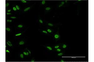 Immunofluorescence of monoclonal antibody to PARP1 on HeLa cell. (PARP1 抗体  (AA 1-100))