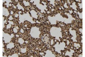 ABIN6277288 at 1/100 staining Mouse lung tissue by IHC-P. (Neural Wiskott-Aldrich syndrome protein (WASL) (Internal Region) 抗体)