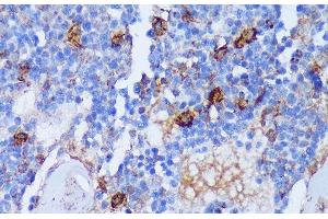 Immunohistochemistry of paraffin-embedded Rat bone marrow using PADI4 Polyclonal Antibody at dilution of 1:100 (40x lens).