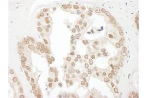 anti-BRCA2 and CDKN1A Interacting Protein (BCCIP) (C-Term) antibody