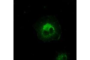 Image no. 6 for anti-Crystallin, alpha B (CRYAB) antibody (ABIN1497644) (CRYAB 抗体)
