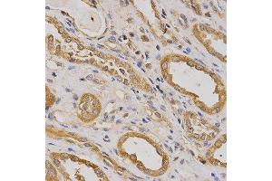 Immunohistochemistry (IHC) image for anti-rho GTPase Activating Protein 25 (ARHGAP25) (AA 1-370) antibody (ABIN3021770)