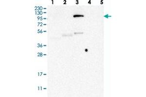 Western blot analysis of Lane 1: RT-4, Lane 2: U-251 MG, Lane 3: Human Plasma, Lane 4: Liver, Lane 5: Tonsil with LEMD3 polyclonal antibody . (LEMD3 抗体)