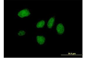Immunofluorescence of purified MaxPab antibody to DIDO1 on HeLa cell. (DIDO1 抗体  (AA 1-544))