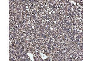 IHC analysis of SLU7 using anti-SLU7 antibody (ABIN7601697).