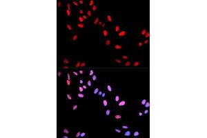 Immunofluorescence analysis of U2OS cell using Phospho-MYC-T58 antibody. (c-MYC 抗体  (pThr58))