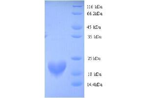 SDS-PAGE (SDS) image for RNA Binding Motif Protein 3 (RBM3) (AA 1-157), (full length) protein (His tag) (ABIN5713782)