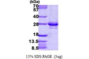 SDS-PAGE (SDS) image for RAB14, Member RAS Oncogene Family (RAB14) (AA 1-215) protein (His tag) (ABIN667486) (RAB14 Protein (AA 1-215) (His tag))