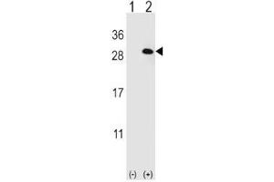 Western blot analysis of EIF4E2 antibody and 293 cell lysate (2 ug/lane) either nontransfected (Lane 1) or transiently transfected (2) with the EIF4E2 gene. (EIF4E2 抗体)