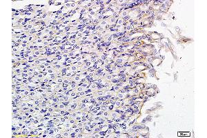 Formalin-fixed and paraffin embedded mouse small intestine labeled with Anti SLCO2B1 Polyclonal Antibody, Unconjugated (ABIN751048) followed by conjugation to the secondary antibody and DAB staining